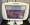 Solta Fraxel Dual Laser Machine